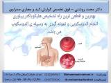 انجام آندوسكوپی و كولونوسكوپی